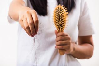 Nadměrné vypadávání vlasů trápí ženy i muže.