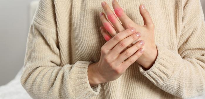 Trápí tě revma? Možná ti pomůže některá z osvědčených babských rad.